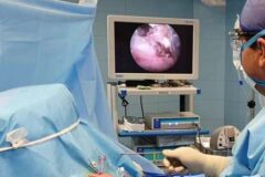 فراهم آمدن امکان عمل مینیسک زانو به روش آرتروسکوپی در بیمارستان شهید دکتر بهشتی بندرانزلی